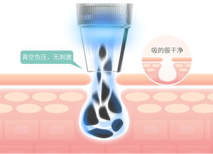 mks美克斯電動毛孔清潔器 告別黑頭粉刺，開啟深層凈澈護膚時代
